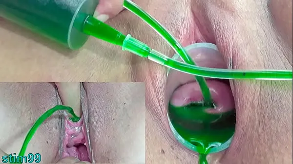 Friss Cervix and Pee Hole Inflation with Injections for Japanese Lesbians felső cső